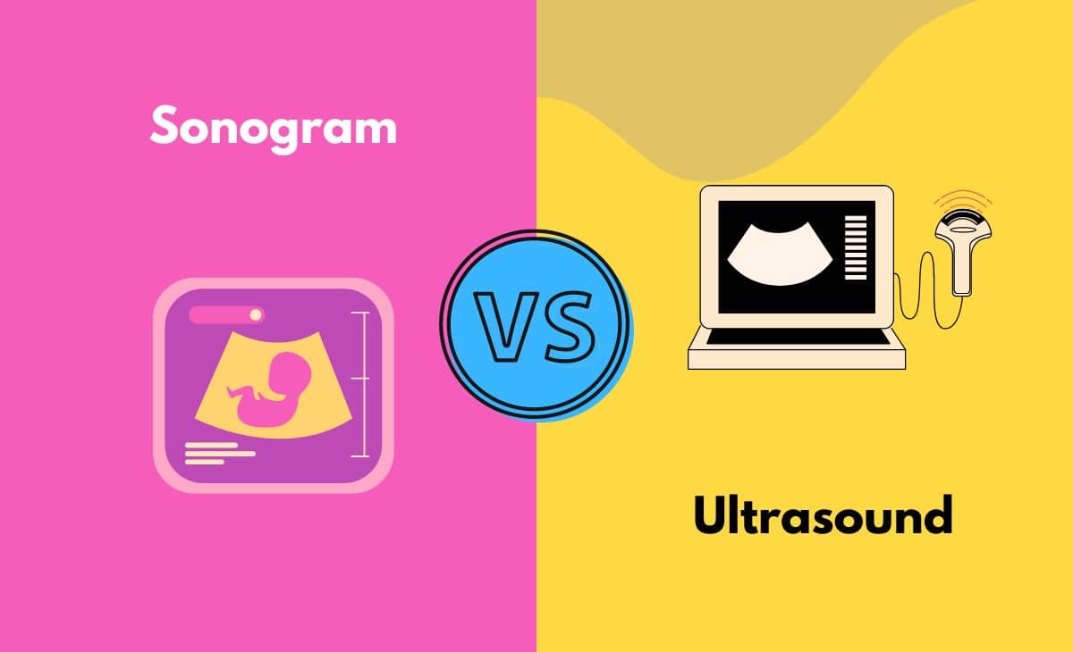 Difference Between Sonogram and Ultrasound