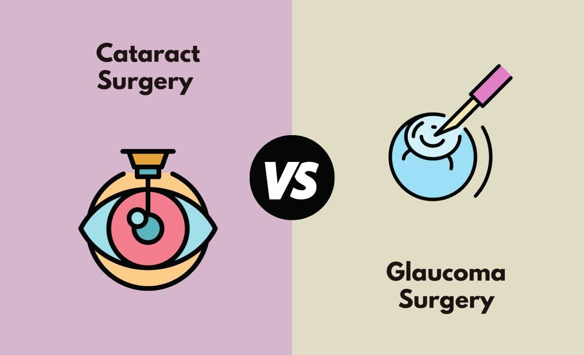 Difference Between Cataract Surgery and Glaucoma Surgery