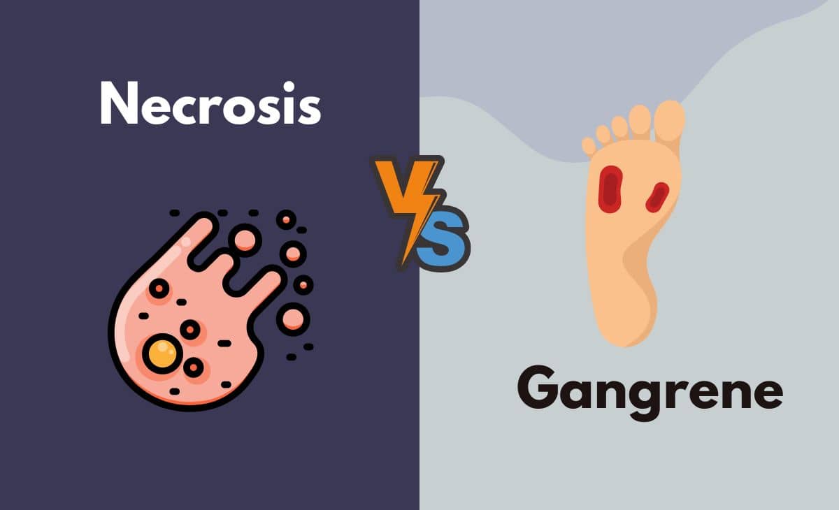 Difference Between Necrosis and Gangrene