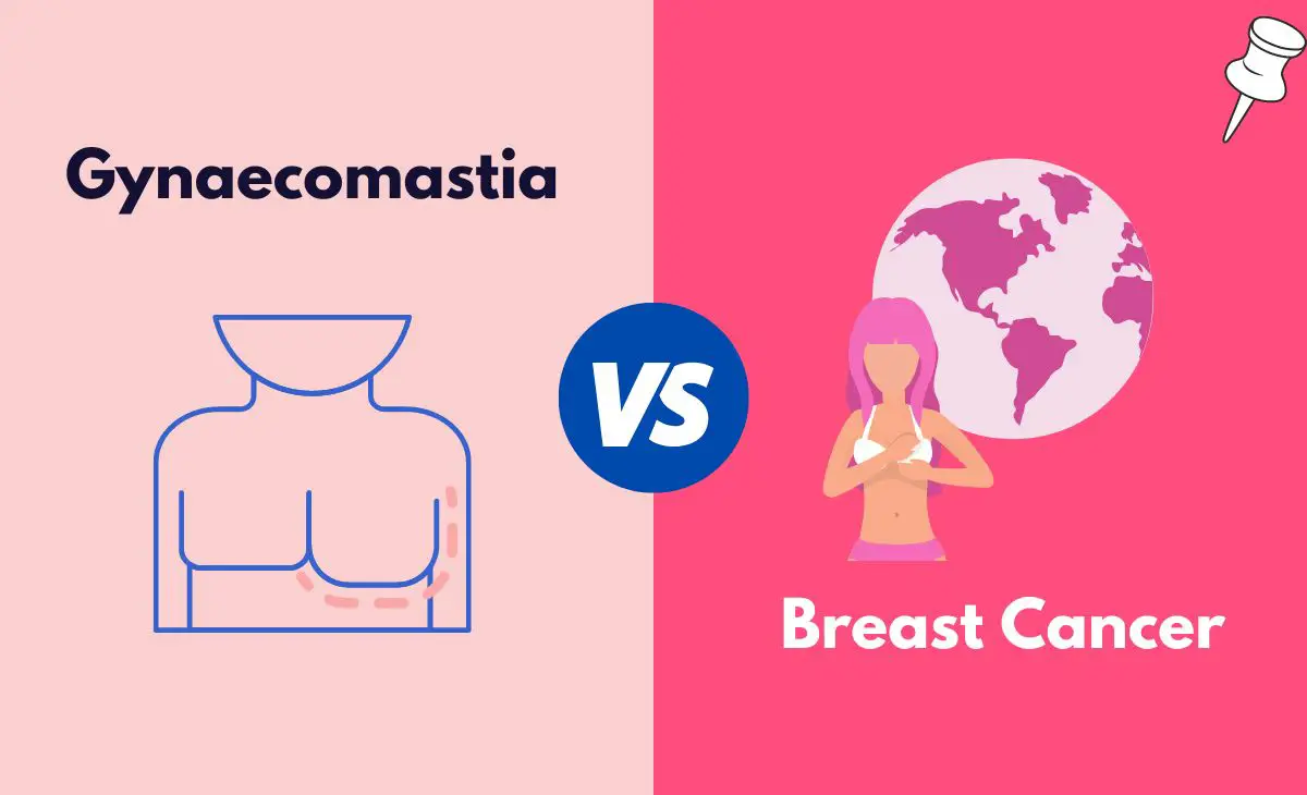 Difference Between Gynaecomastia and Breast Cancer