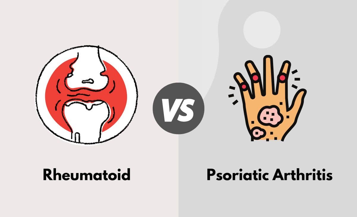 Difference Between Rheumatoid Arthritis and Psoriatic Arthritis