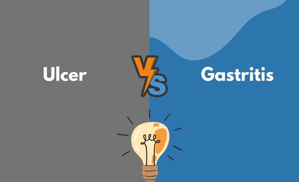 Difference Between Ulcer and Gastritis
