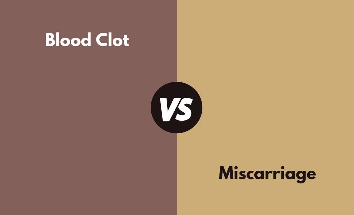 Difference Between Blood Clot and Miscarriage