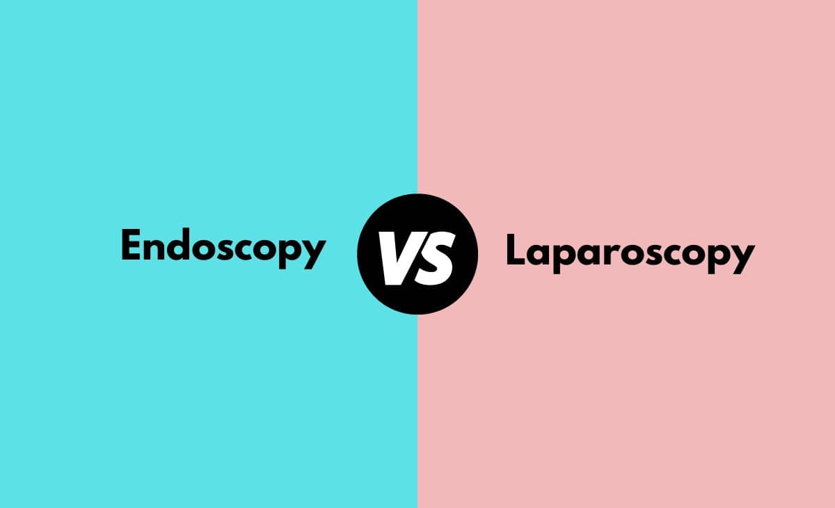 Difference Between Endoscopy and Laparoscopy