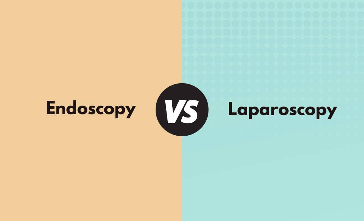 Difference Between Endoscopy and Laparoscopy