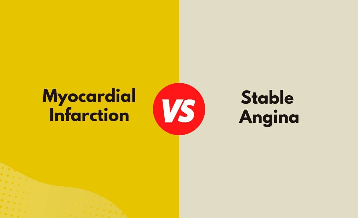 Difference Between Myocardial Infarction and Stable Angina