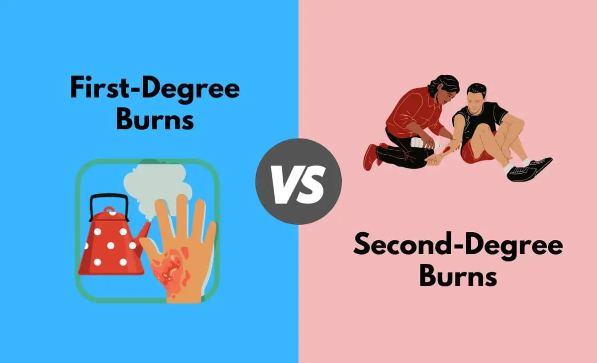 Difference Between First-Degree Burns and Second-Degree Burns
